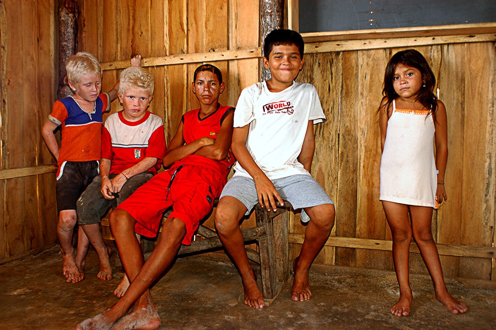 Litoral norte do Maranhão, imagem de meninos albinos da ilha dos Lençóis