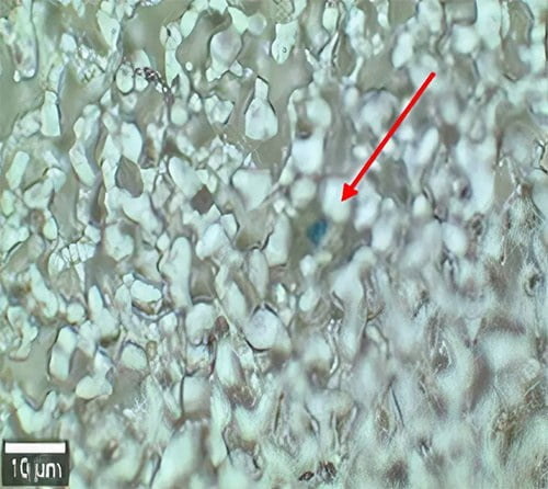 Imagem de microplástico em pulmão humano
